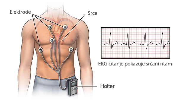 Holter monitor sa očitavanjem EKG-a