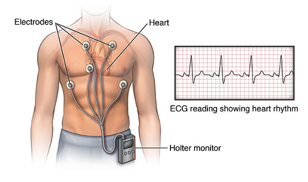 Hotler monitor with ECG reading